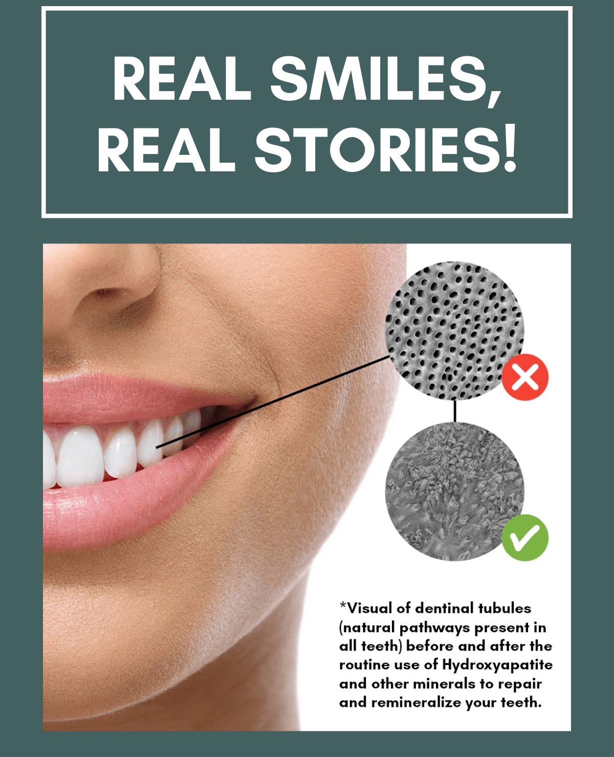 Real Smiles, Real Stories! Visual of dentinal tubules (natural pathways present in all teeth) before and after the routine use of Hydroxyapatite and other minerals to repair and remineralize your teeth.