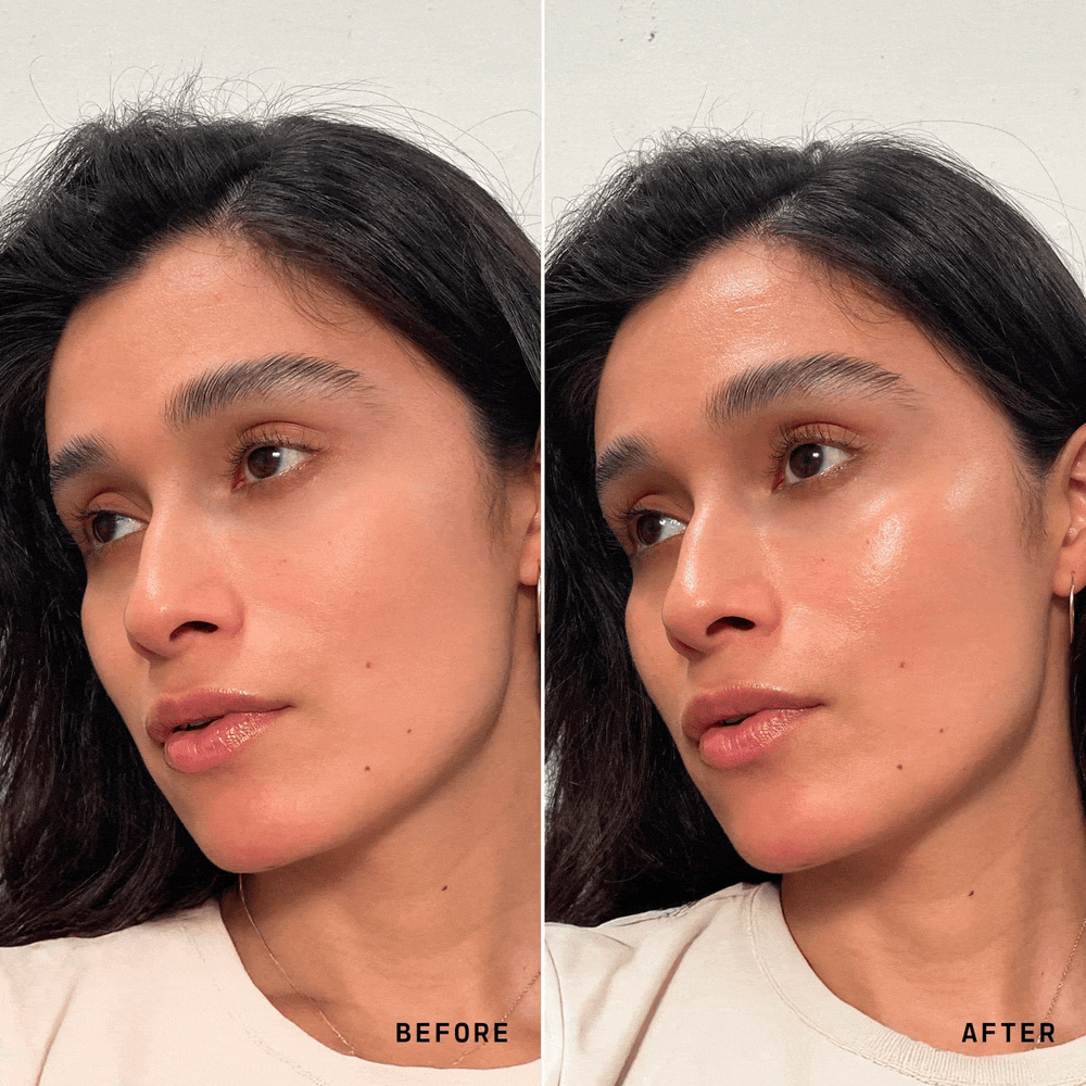 Before and After
