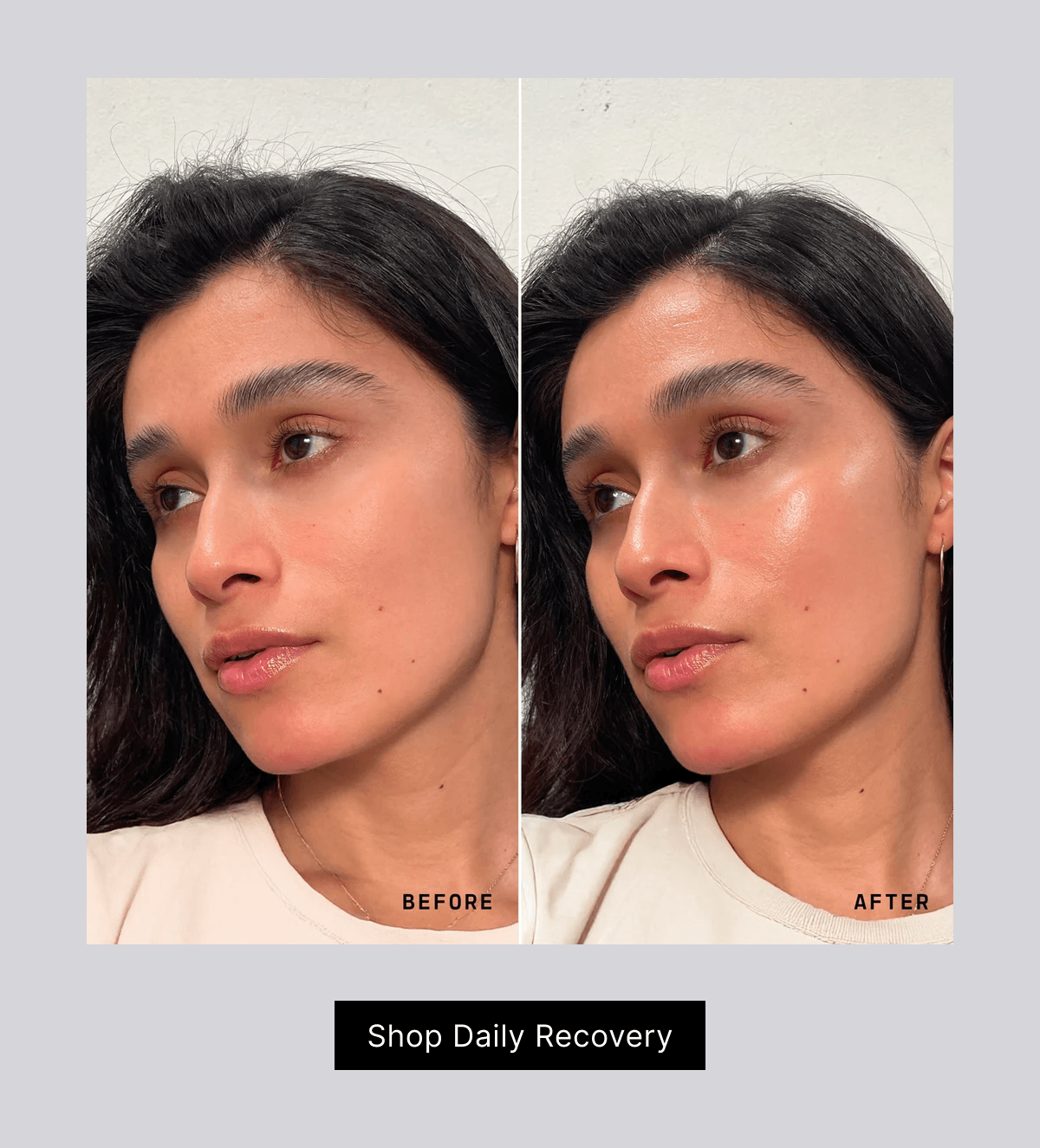 Before and after using Daily Recovery. Shop Daily Recovery.