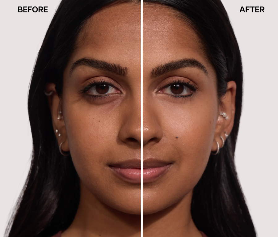 Before and after