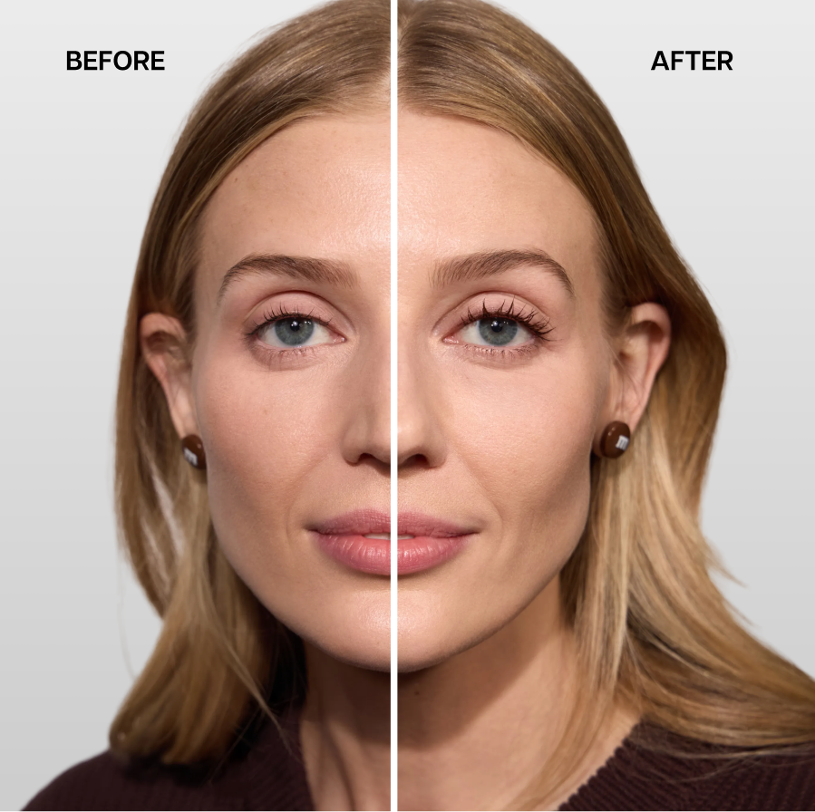 Before and after image