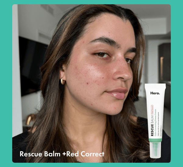 Rescue Balm +Red Correct