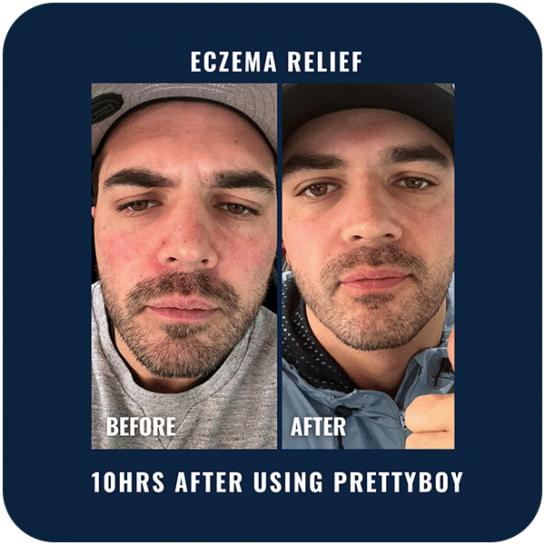 Before and After