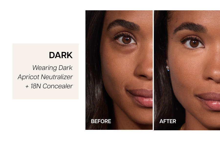 Dark