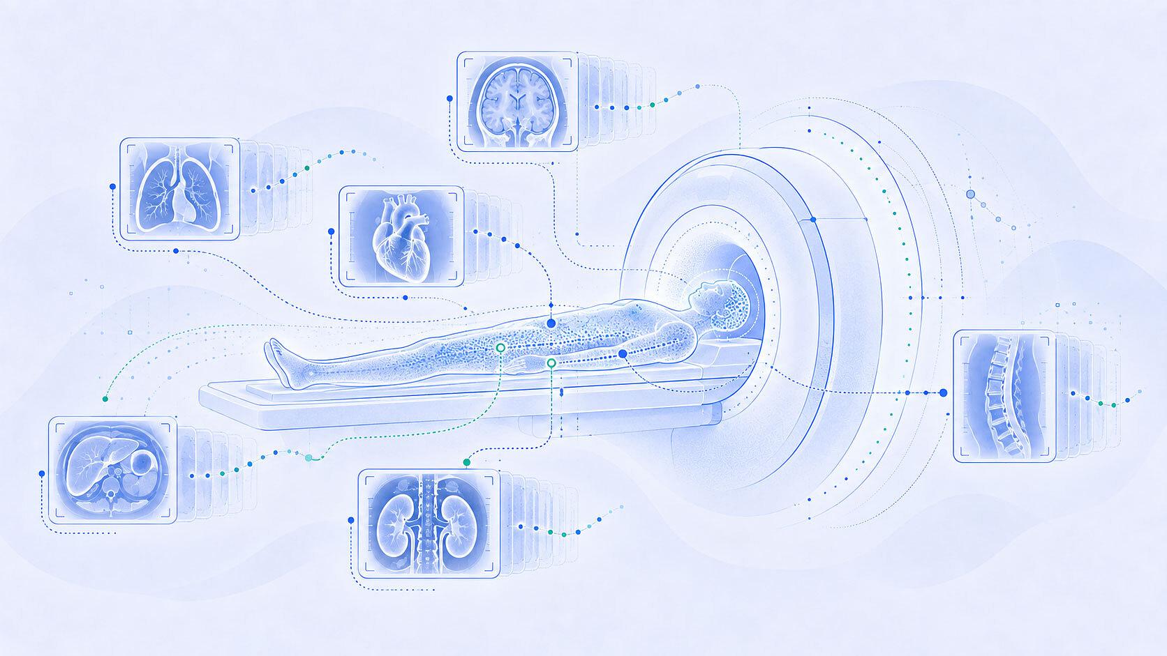 Is whole-body MRI worth it?
