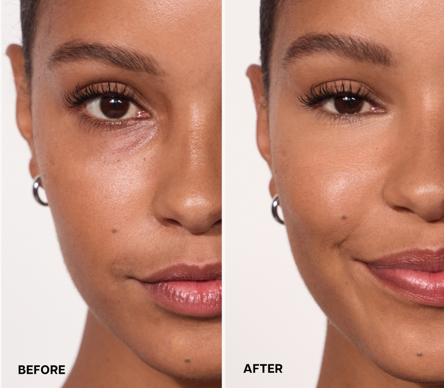 Before and after